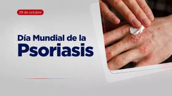 110829-con-tratamiento-medico-es-posible-reducir-sintomas-y-brotes-de-psoriasis