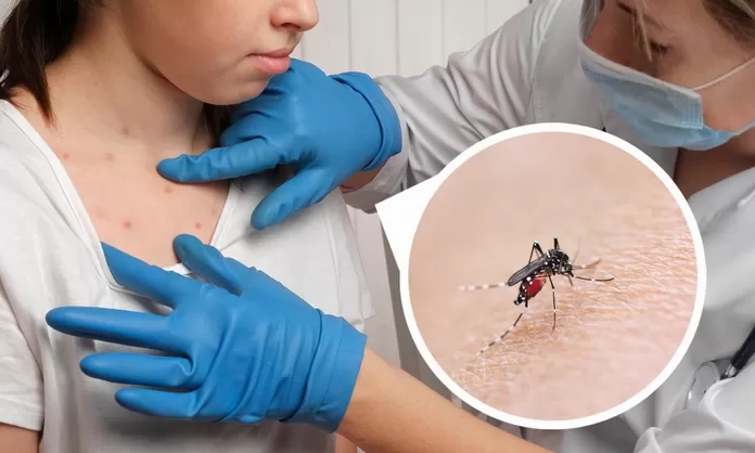 util-e-interesante-dengue-que-sintomas-cuanto-dura-y-tratamientos-n488667-696x418-1062200